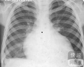 心包积液吃瓜好不,适量吃瓜，健康生活新选择